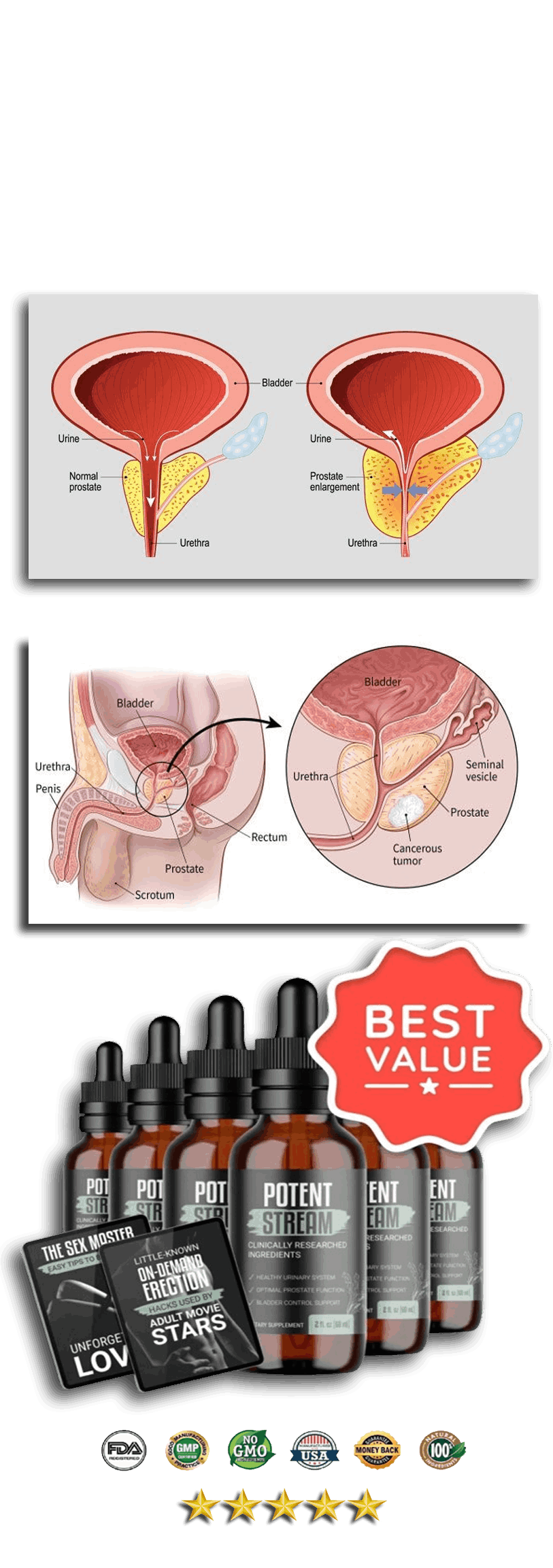 potent stream supports health prostate